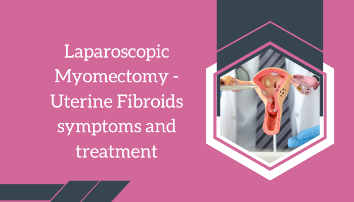 laparoscopic myomectomy procedure