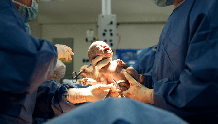 What are the indications/causes for a c-section delivery? 1 c section delivery