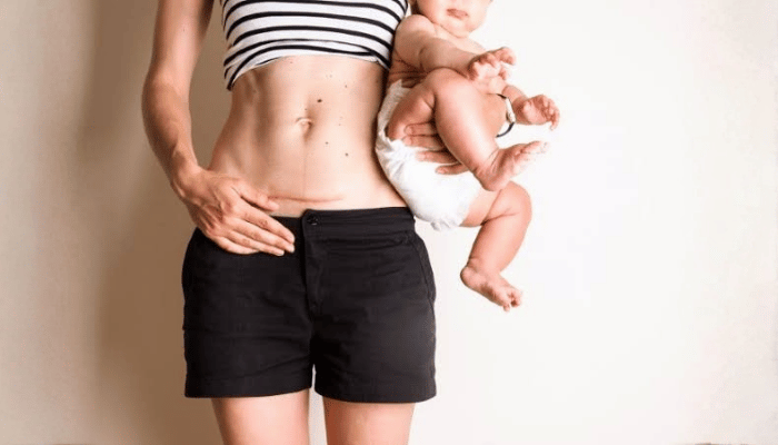 What are the indications/causes for a c-section delivery? 2