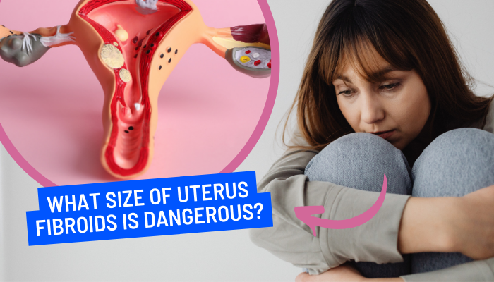 Uterus Fibroids