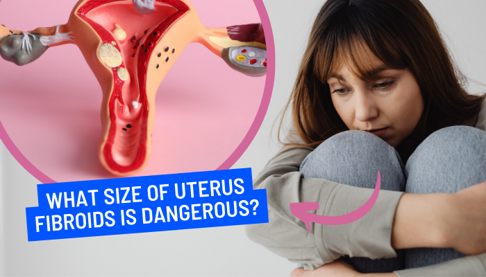 how fibroids are measured