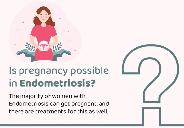 Pregnancy after Endometriosis