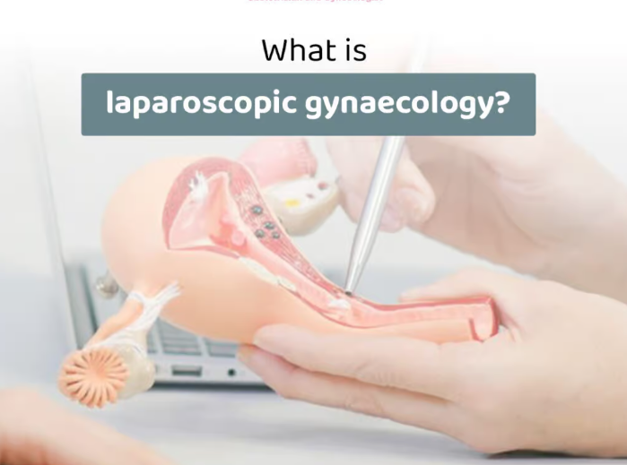 What is Laparoscopic gynecology