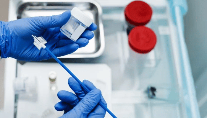 What is Pap smear test, and how is it done? 2
