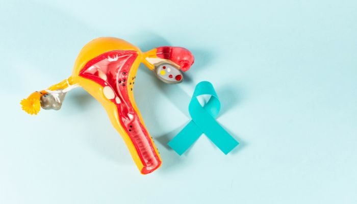 How to diagnose ovarian cancer