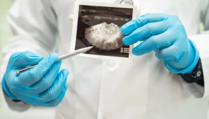 Abnormal Vaginal Bleeding