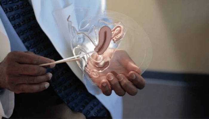 Postcoital Bleeding 2 Postcoital Bleeding
