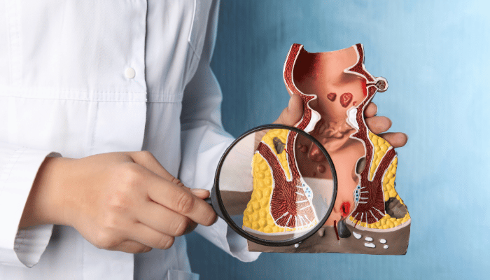 Colposcopy Procedure in Dubai 2