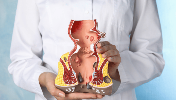 Colposcopy Procedure in Dubai 3