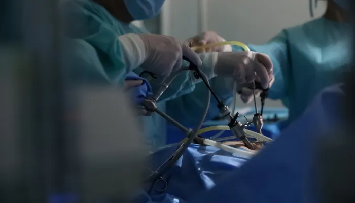 Benefits of Laparoscopic Surgery in Dubai