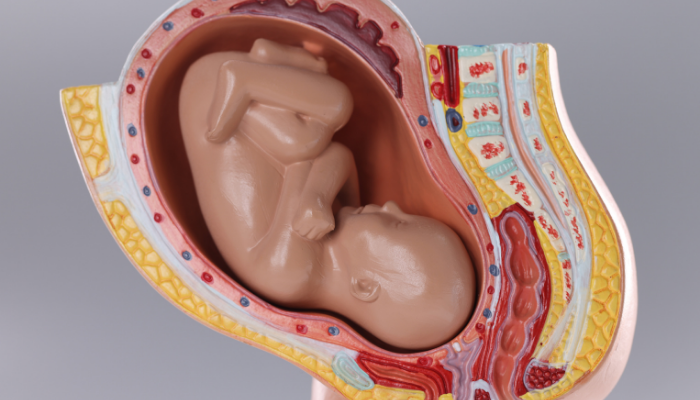 Anterior Placenta Treatment in Dubai 3 Anterior Placenta Treatment in Dubai