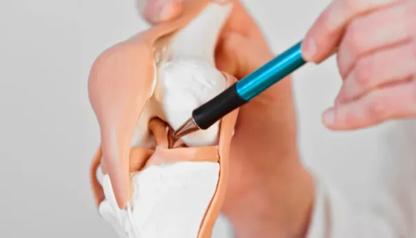 treatment for anterior placenta pic 3