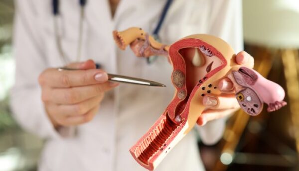 Cervical Cerclage pic