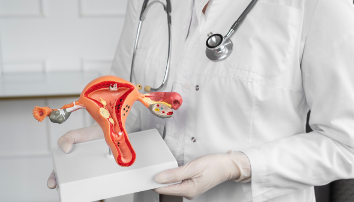 Hysterectomy for Cancer Treatment in dubai 3 Hysterectomy for Cancer Treatment in Dubai