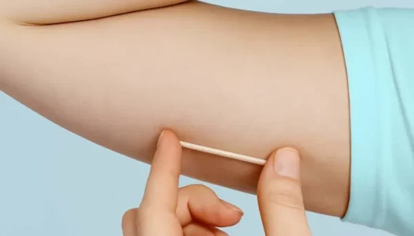 Implanon Dubai 3 implanon in dubai blog pic 3