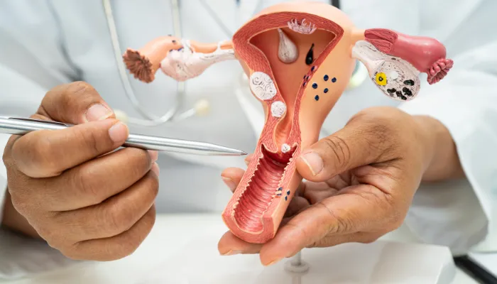 Uterine Fibroid Treatment in Dubai