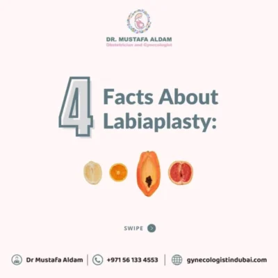 Four facts about labiaplasty patient education graphic